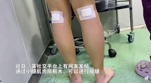 瘦小腿的视频,跟拜拜肉说拜拜！