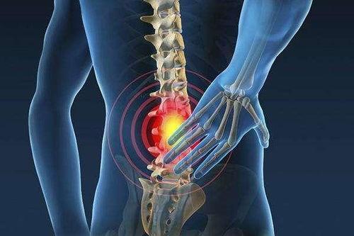 养生堂腰间盘突出视频,腰间盘突出防治之道