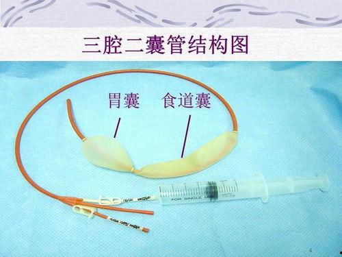 三腔二囊管操作视频,三腔二囊管操作步骤详解及要点解析