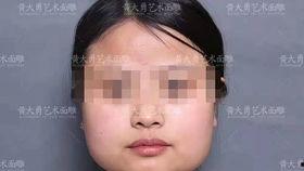 瘦脸的视频,跟随视频教程打造精致小脸