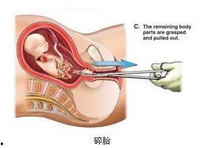 子宫视频,探索女性生命之源的神奇之旅