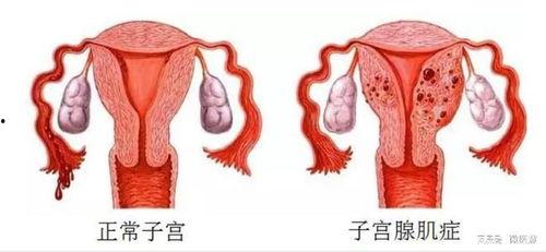 子宫视频,探索女性生命之源的神奇之旅