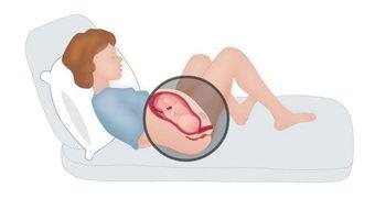 阴道分娩视频,真实记录产妇分娩瞬间