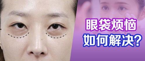 去除眼袋手术视频,专业视频带你直观了解