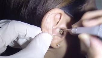 挖耳视频,揭秘日常生活中的健康养生之道